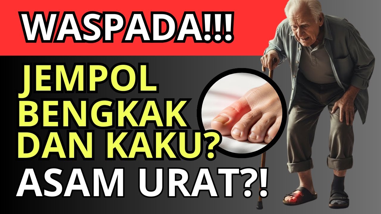 PERINGATAN‼️Jempol BENGKAK dan KAKU Jangan dianggap Sepele, Ini Pemicunya!