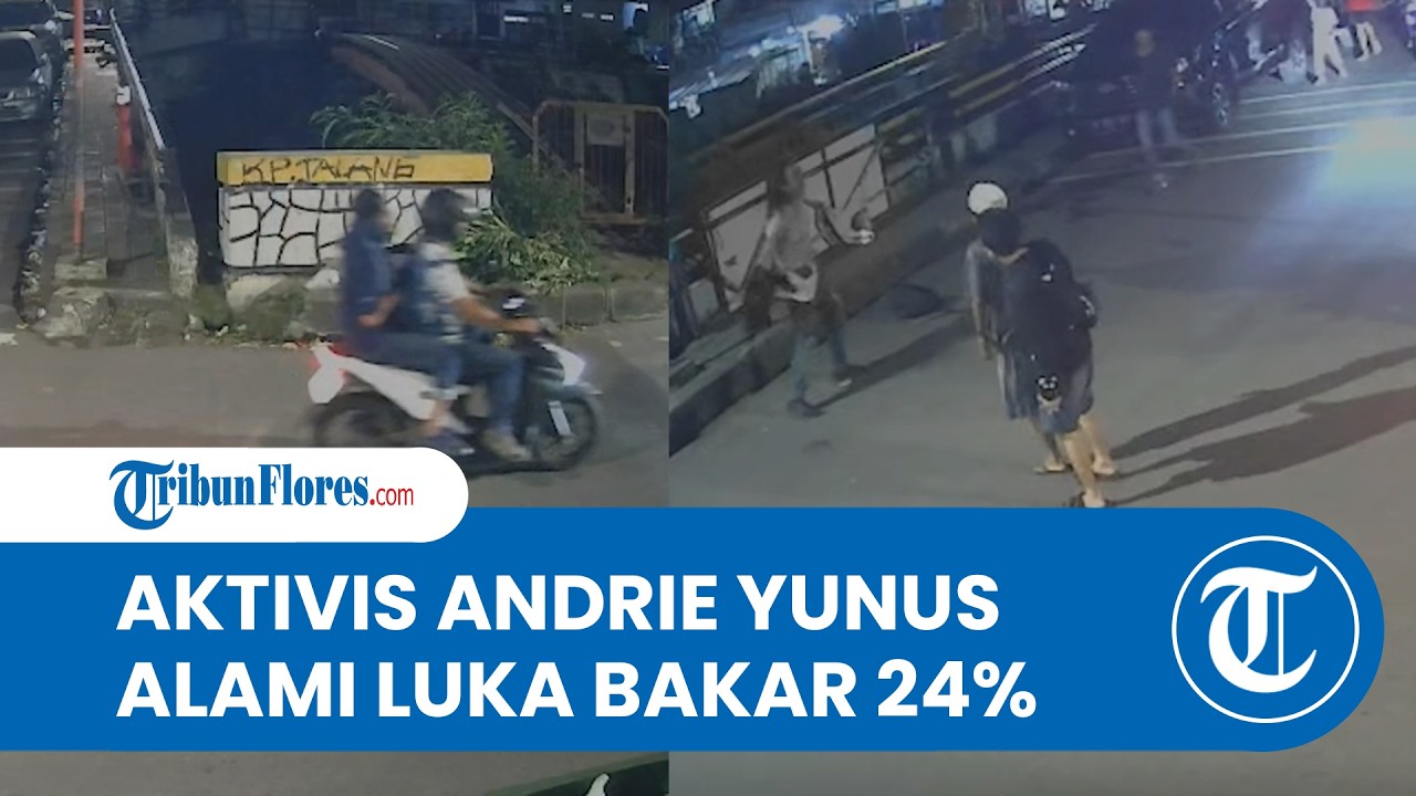 Kondisi Andrie Yunus seusai Disiram Air Keras: Alami Luka Bakar 24% dan Harus Operasi Mata