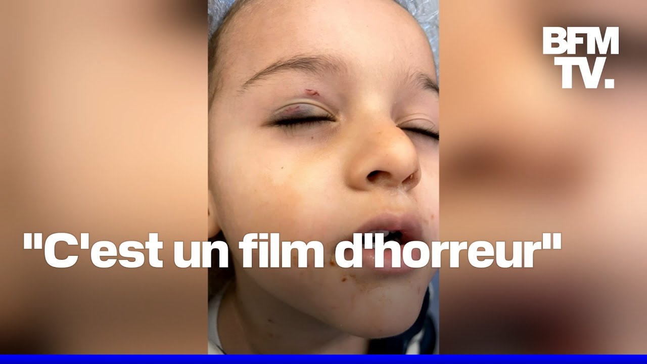 &Agrave; Cannes, un enfant endormi se fait mordre par un rat en pleine nuit