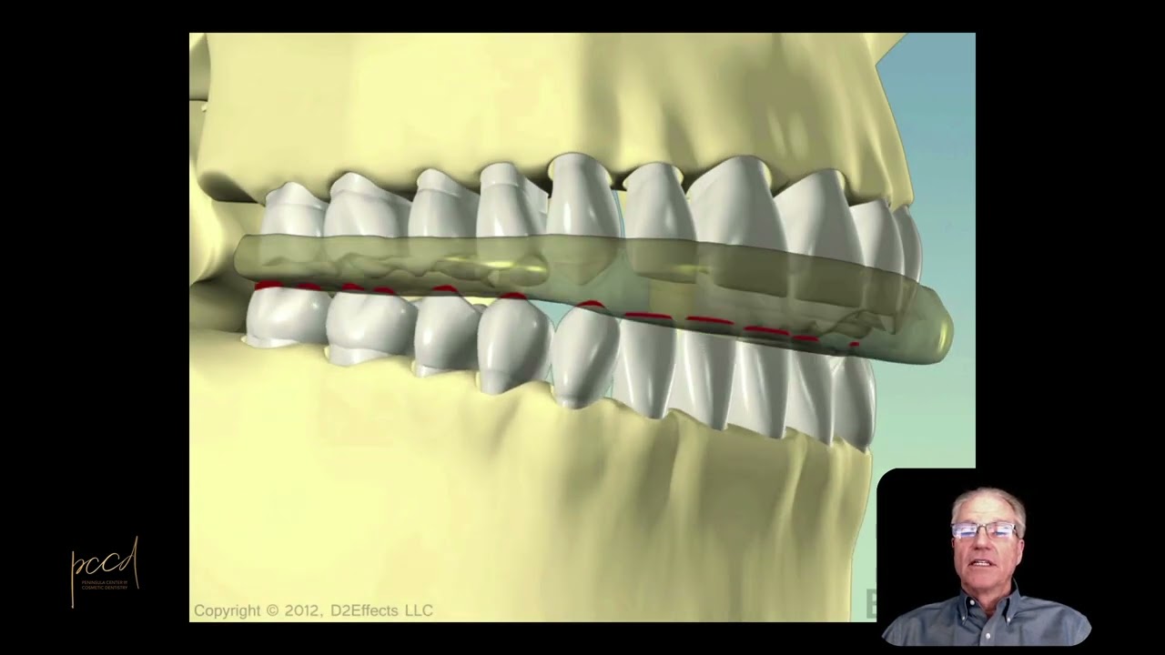 Dental Orthotics for TMJ and Jaw Pain | PCCD Mountain View