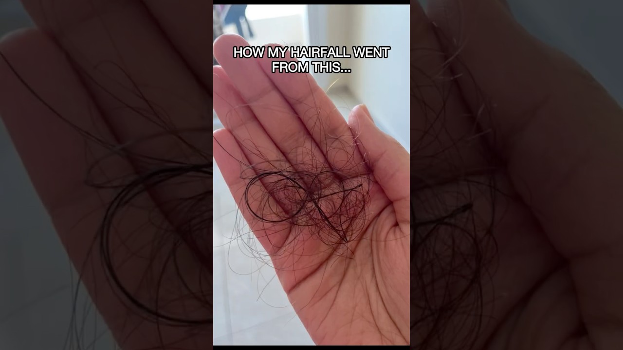 How to stop hair fall and regrow hair? Dermatologist explains. Best hair loss treatment | Hair care