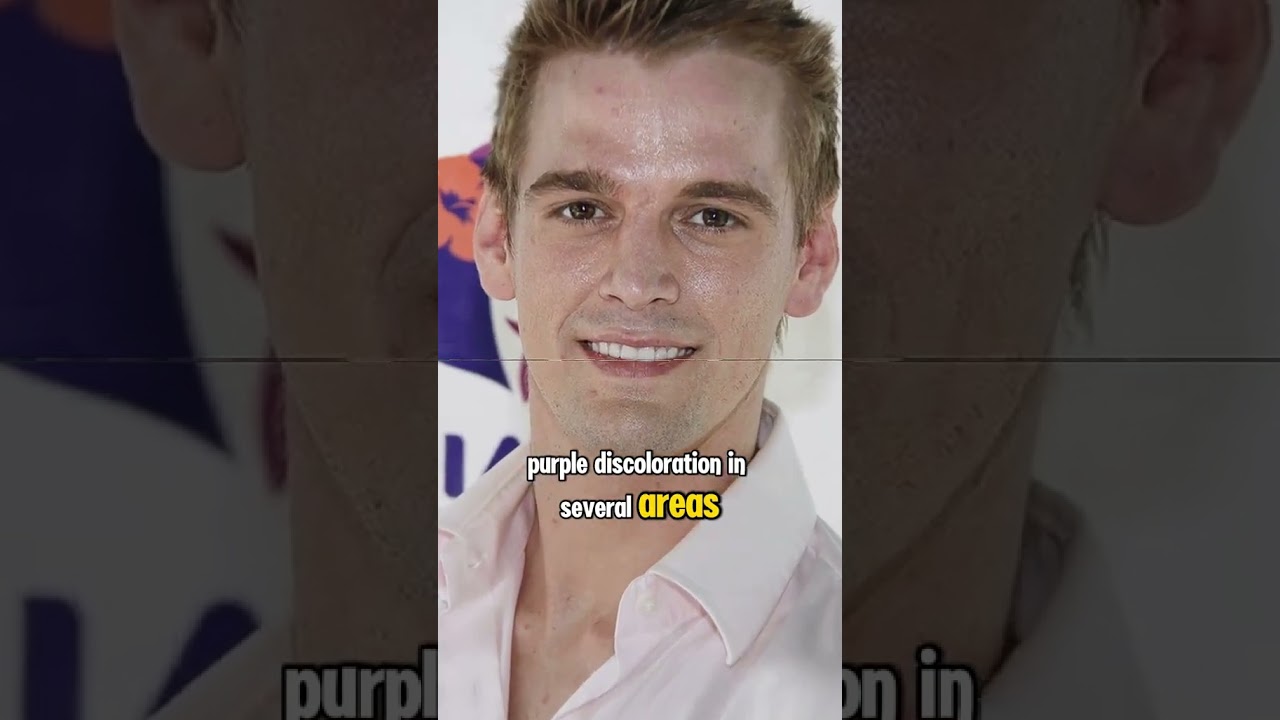 Famous Autopsies Aaron Carter was Diddys victim #actor #celebrities #famous#celebrity