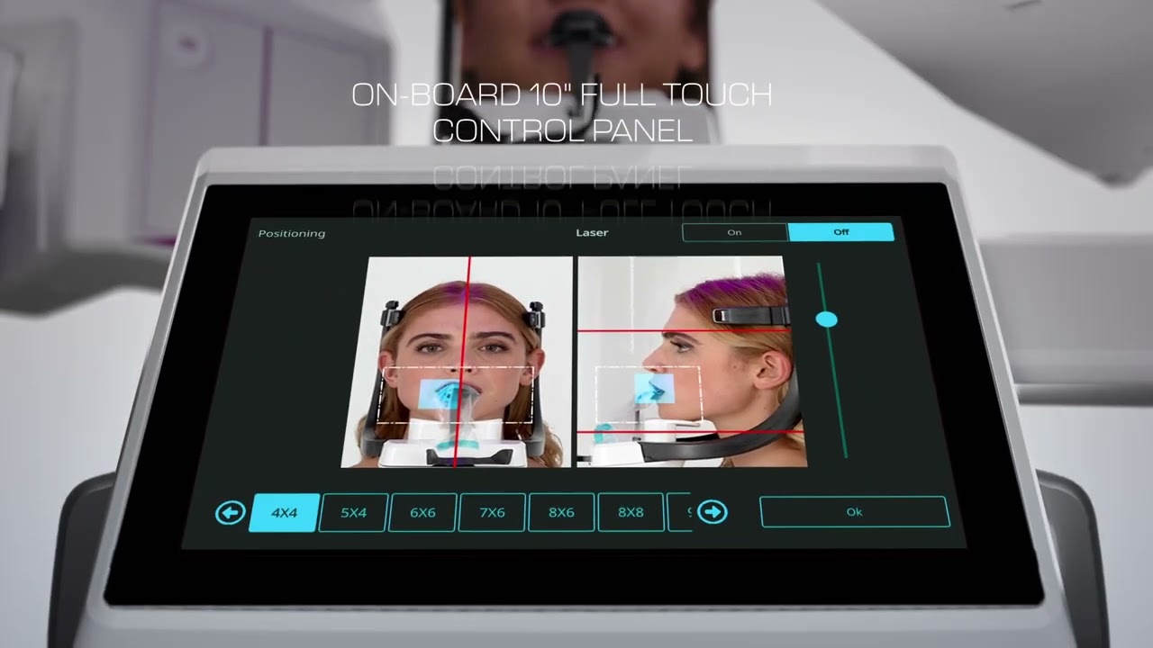 Myray Hyperion X9 pro FullView AI EN