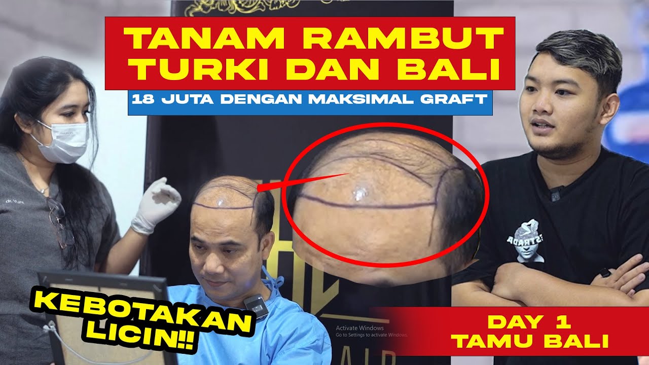 KEBOTAKAN LICIN!! DAY 1 TANAM RAMBUT BALI INDONESIA!!