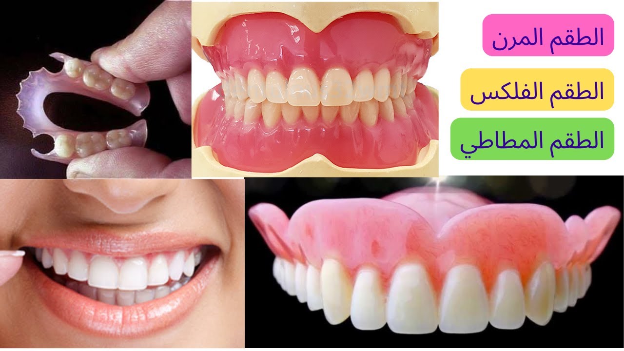 طقم الأسنان المرن، طقم الأسنان الفلكس، طقم الأسنان المطاط. هو طقم أسنان ضد الكسر وسهل الاستخدام.