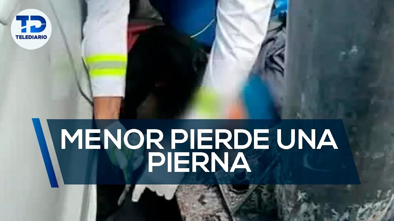 Menor pierde pierna tras ser atropellado; conductora quedaría libre