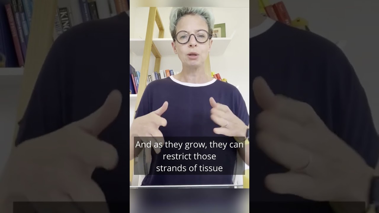 How to check your breasts #breastcancer