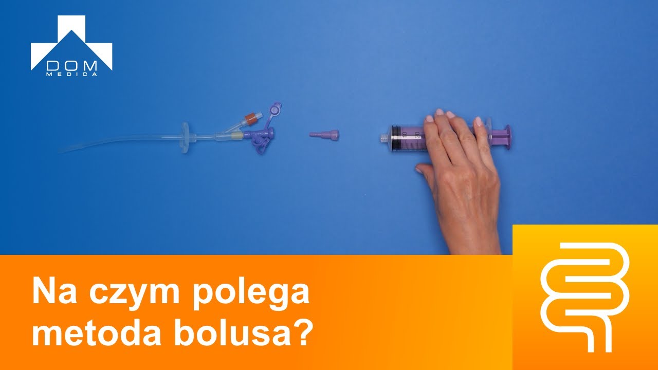Żywienie dojelitowe - podaż diety metodą bolusa