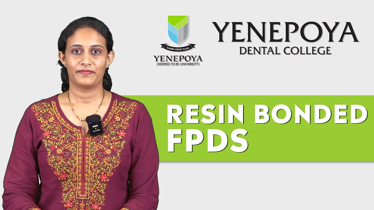 Resin Bonded Fixed Partial Dentures | Prosthodontics | Yenepoya Dental College