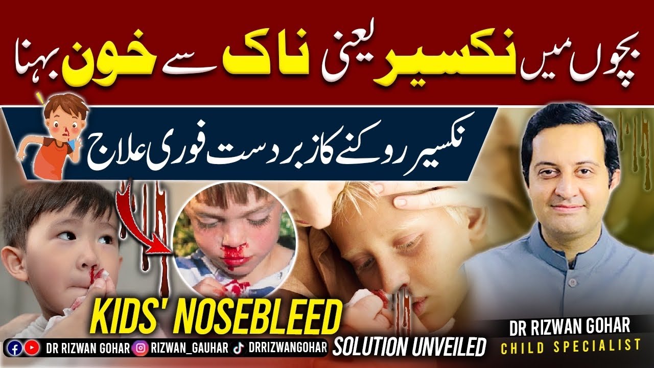 Amazing treatment for NOSE BLEED🤥🐽 unveiled in KIDS #nosebleed #treatment