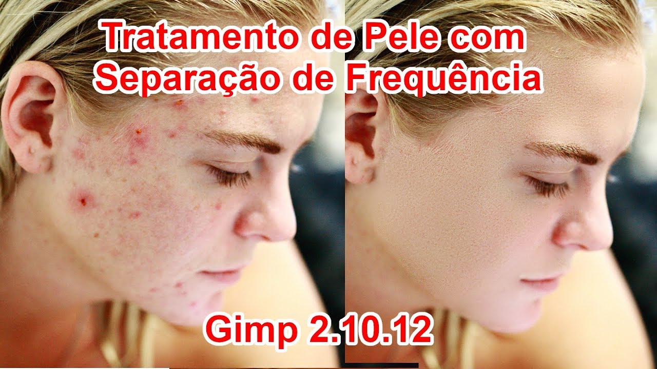 Tratamento de Pele com Separação de Frequência no Gimp 2.10.12