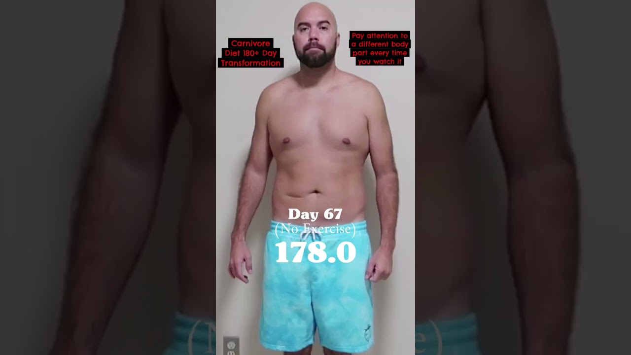 🥩🔥 Carnivore Diet Before And After Results 180 Day Low Carb Keto WeightLoss Transformation #shorts