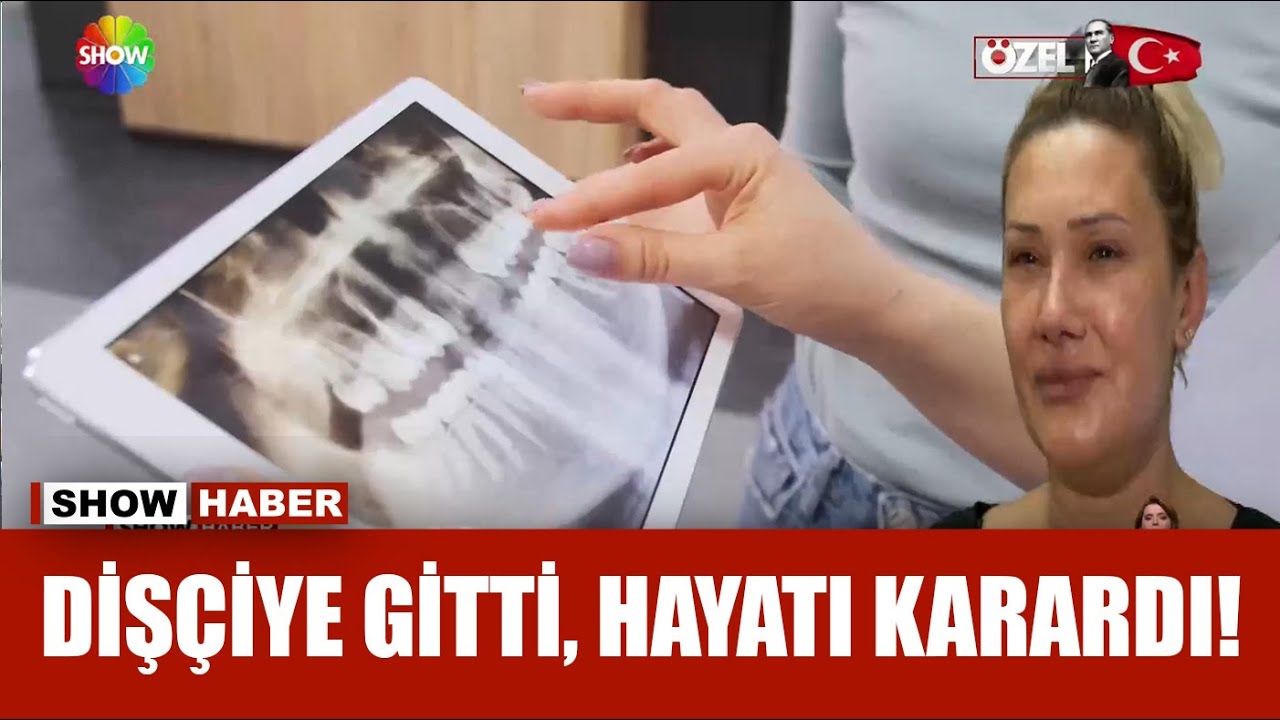 2 diş için gitti, 18 dişi çekildi!