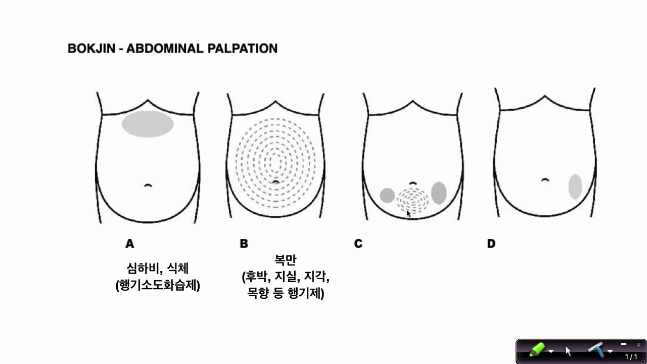 한의학-대변진단,대변의 색, 모양,복진에 따른 변비 치료- 승기탕,육마탕,마자인환,제천전,윤장환