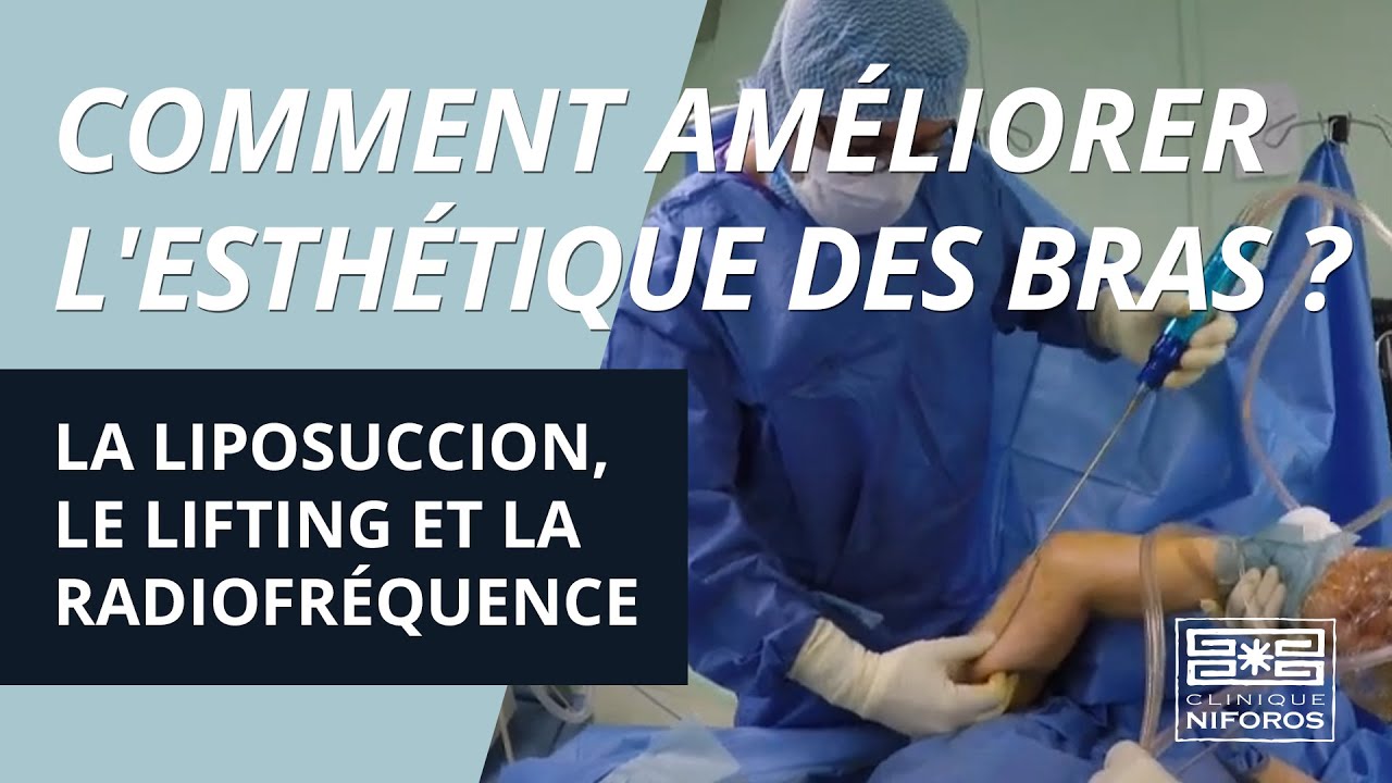 Comment améliorer l'esthétique du bras par la liposuccion, lifting et radiofréquence ?