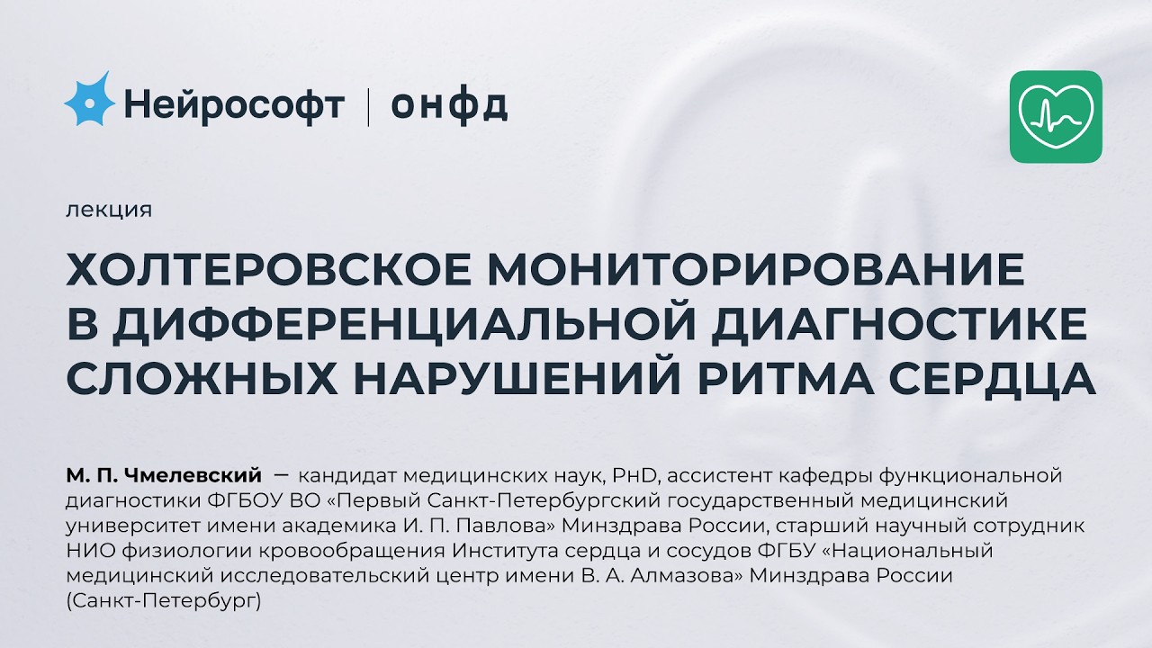 Холтеровское мониторирование в дифдиагностике сложных нарушений ритма сердца