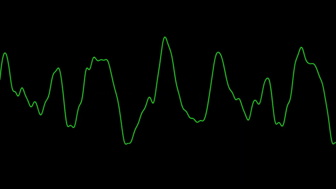 On the Phone w/Bruce Martire: Nitty-gritty of Adult Magazine Business 1982