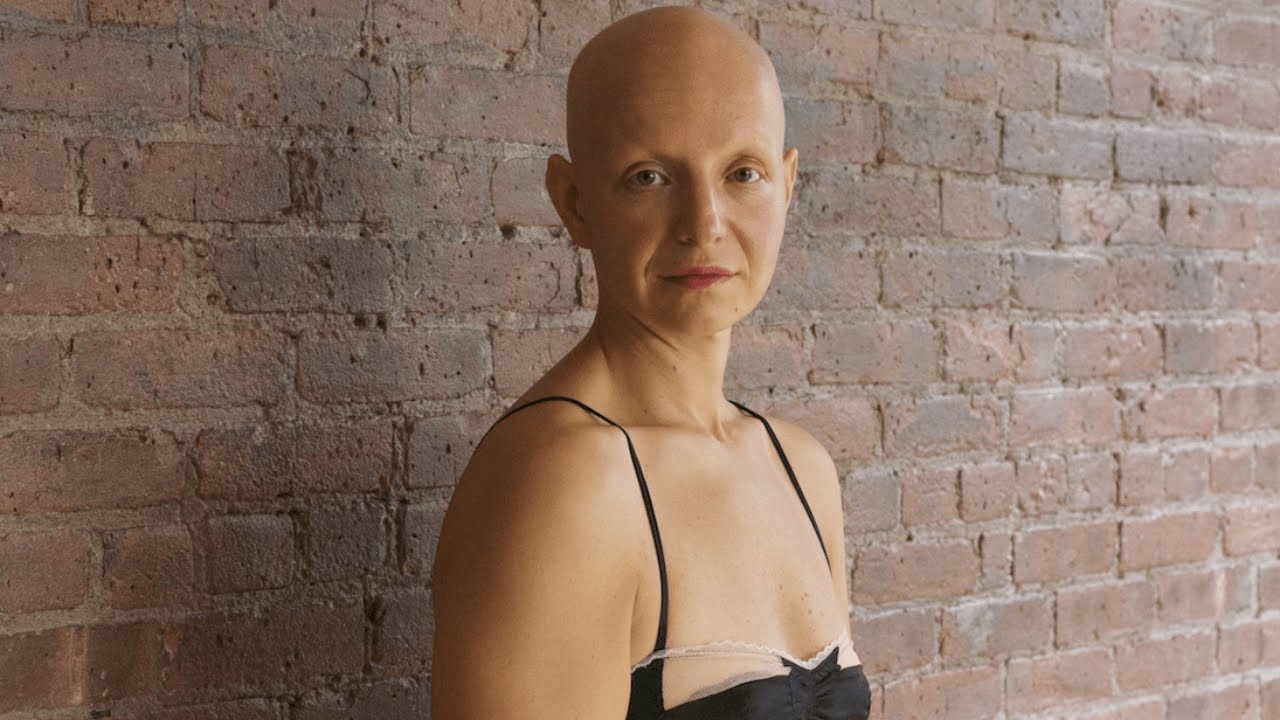 You Don’t Need Hair to Be Beautiful: Rachel Fleit