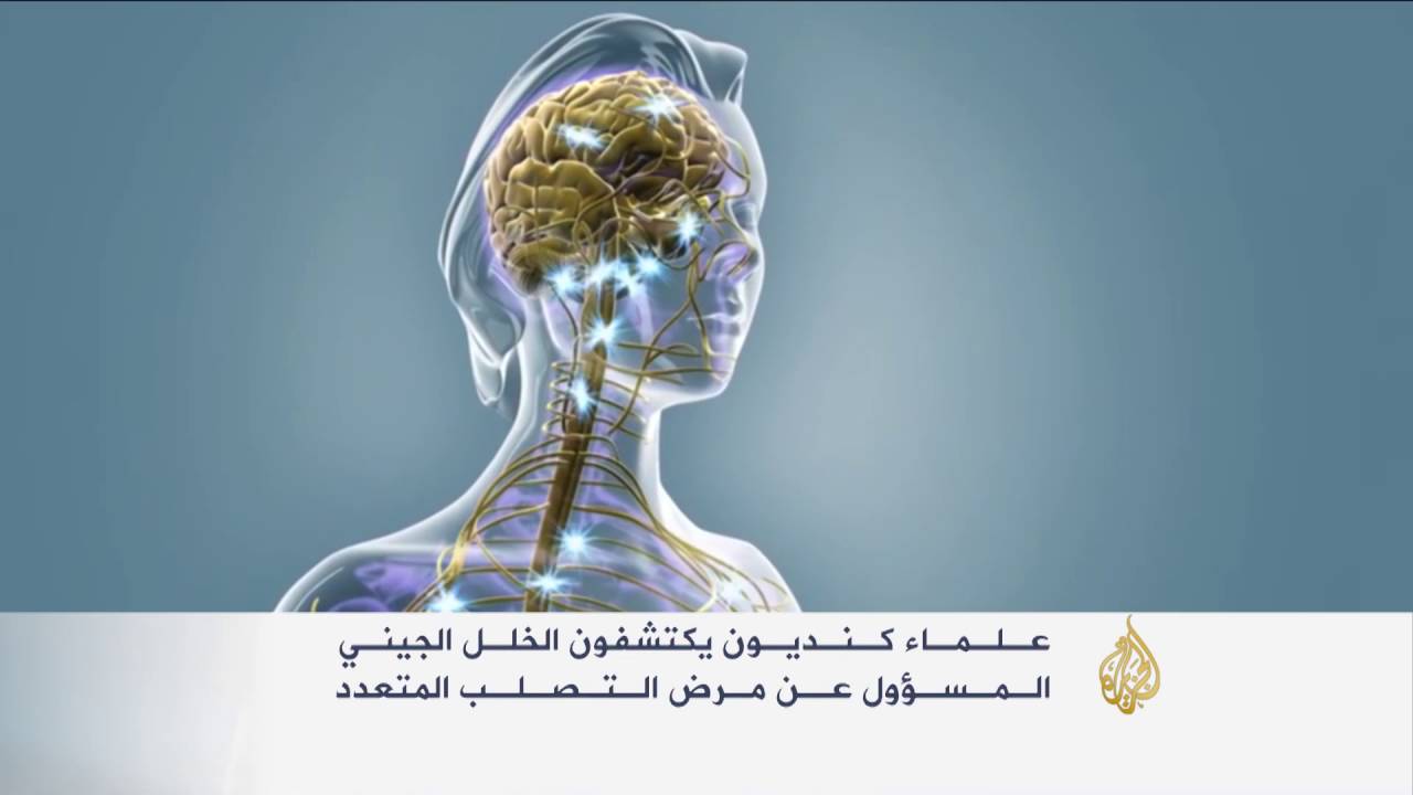 اكتشاف الخلل الجيني المسبب لمرض التصلب المتعدد