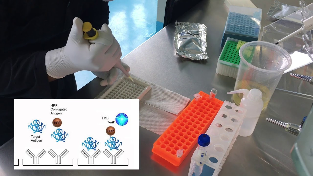 Determinación de T4 (ELISA competitivo)