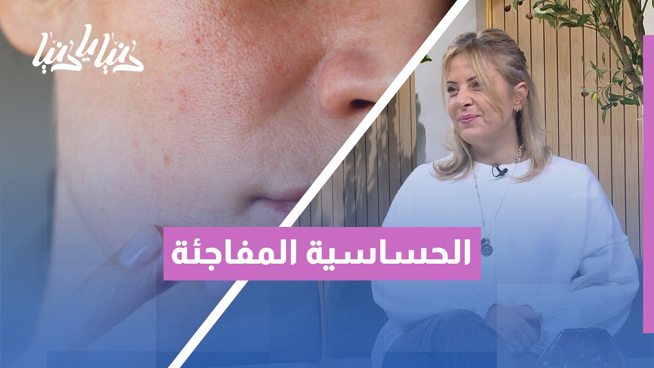 الحساسية المفاجئة: لماذا يرفض جسمك أطعمة كنت تأكلها لسنوات؟ 🍤🚫