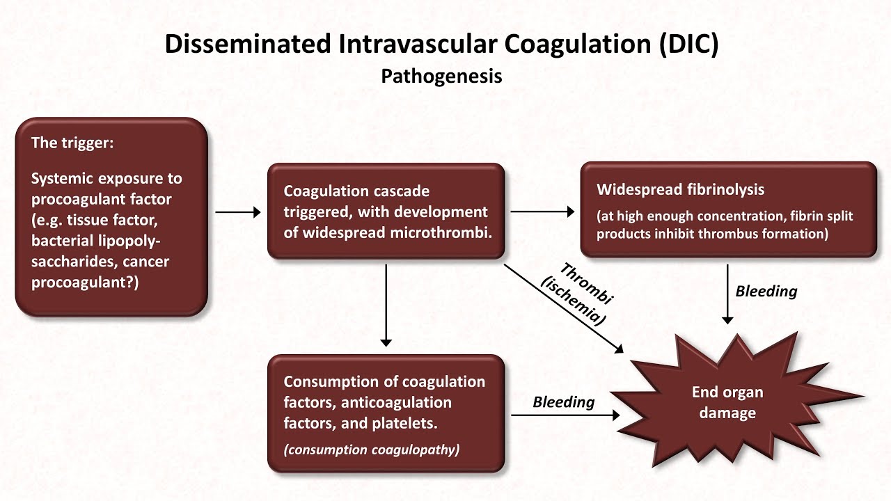 Thrombocytopenia: Hemostasis - Lesson 8