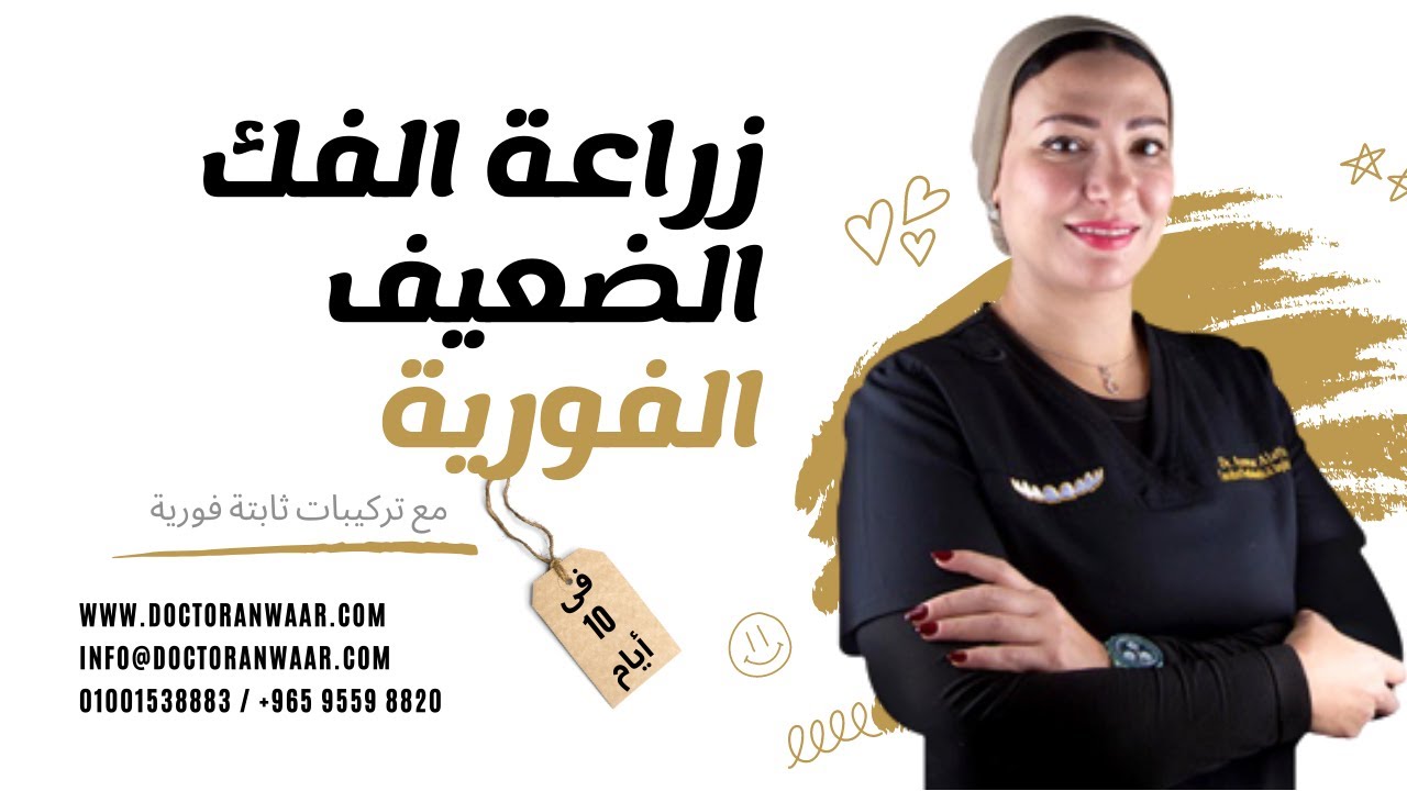 زراعة فكين فورية مع دكتورة أنوار العطار - غيرت حياة واعادت الابتسامة