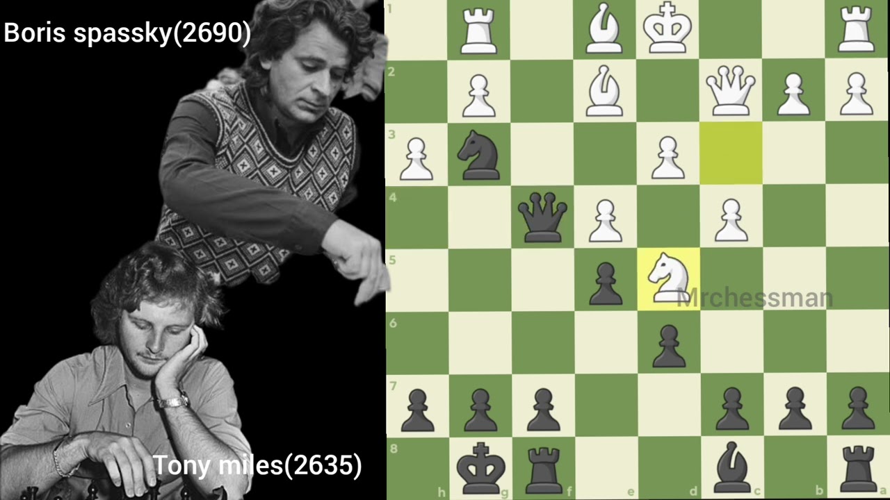 Amazing chess match ♟️👸⏩ on Day 20 #chess #chessmatch #chessgames 