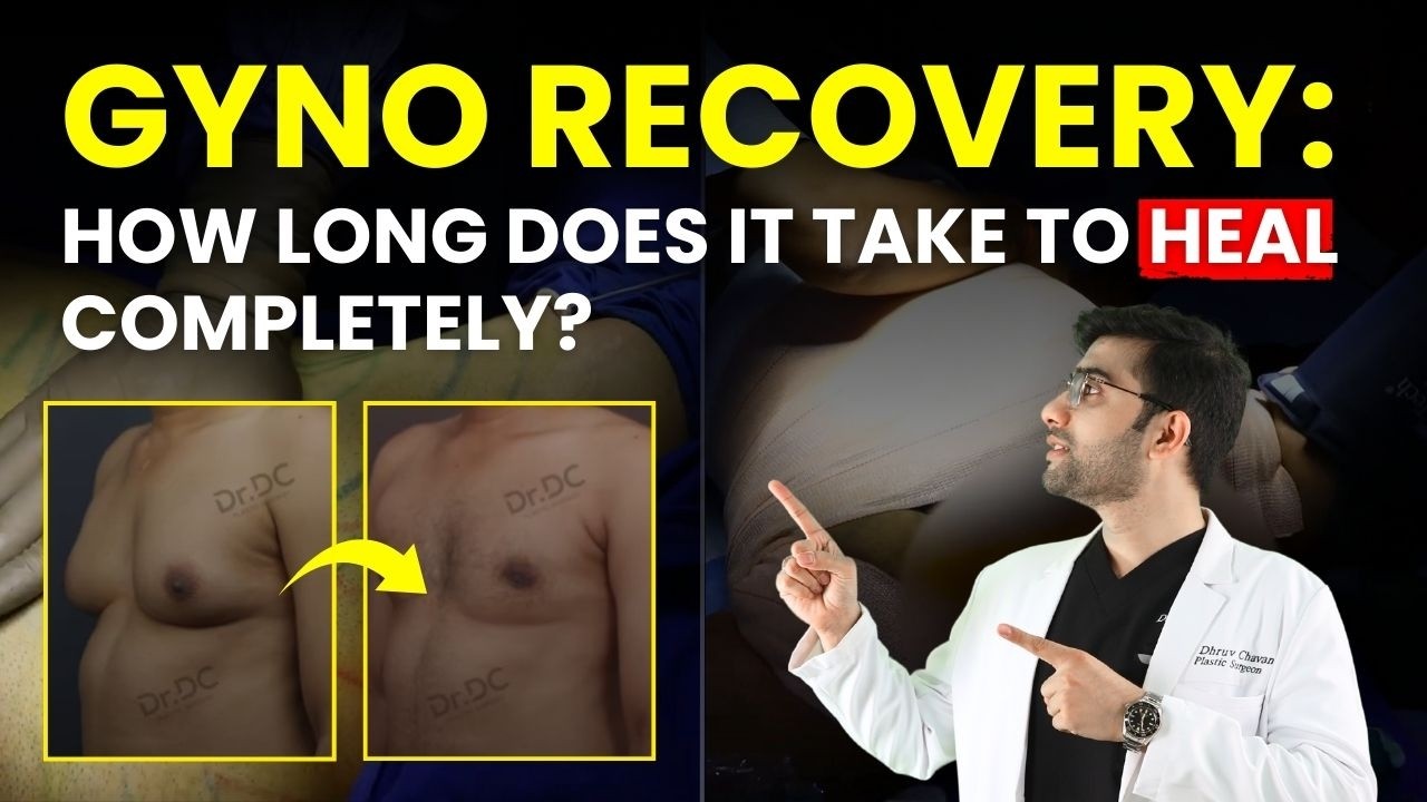 2025 Gynecomastia Surgery के बाद Life कैसे बदलेगी? 🛑 Gyno Recovery Day 1 से Week 6 तक की Journey!
