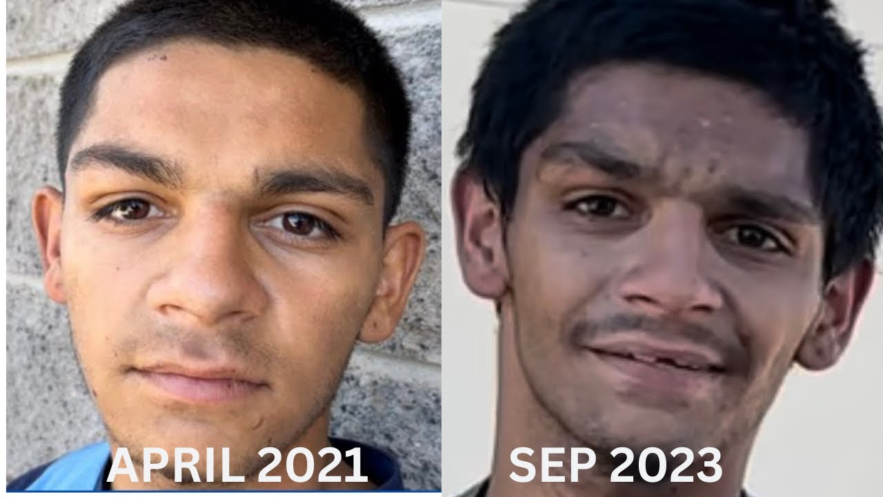 24 Year Old Jonathon 2 Years Later