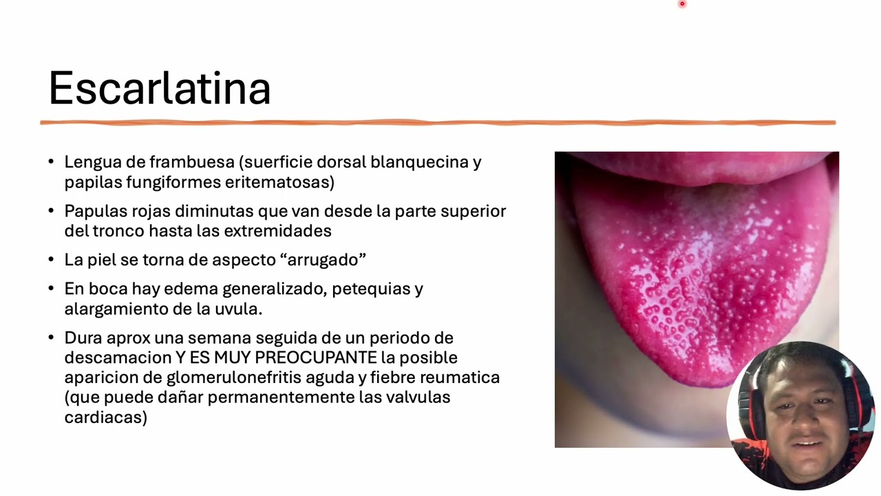 sapp cap 7 pt 6 de 11 streptococcus