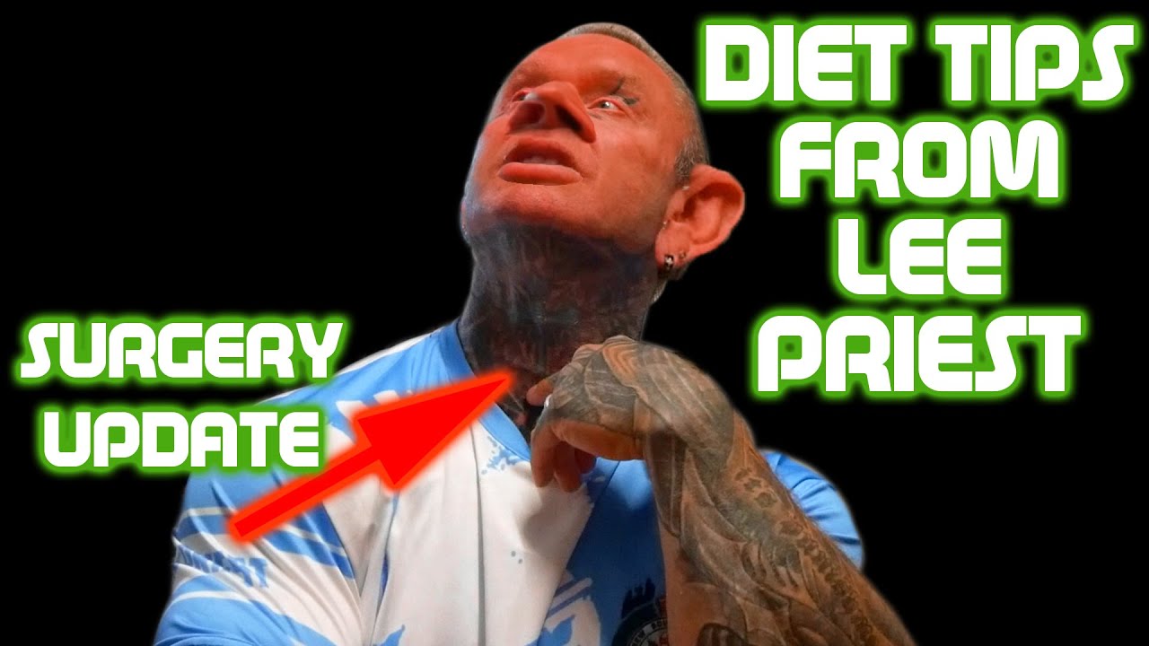 LEE PRIEST: Surgery Update + Diet Tips