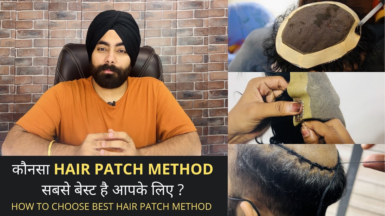 How To Choose Best Hair Replacement Method For You | Full information about Different Methods