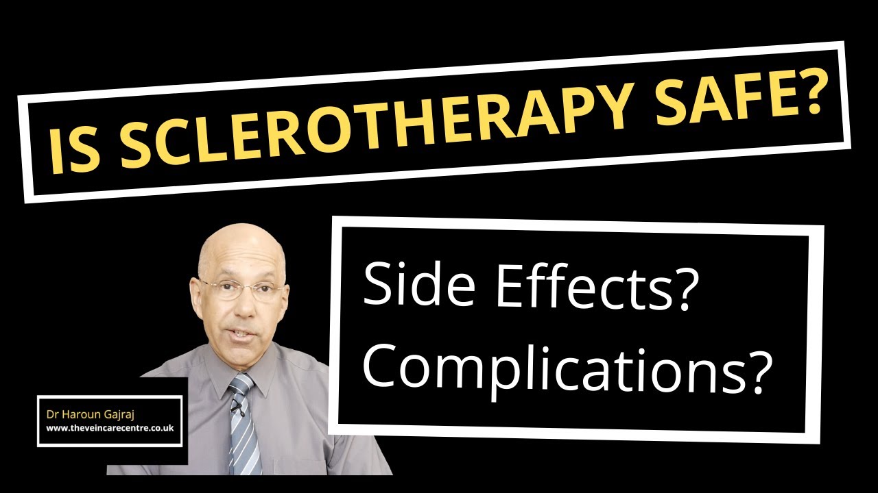 Is Sclerotherapy Safe? | Side Effects and Complications of Sclerotherapy