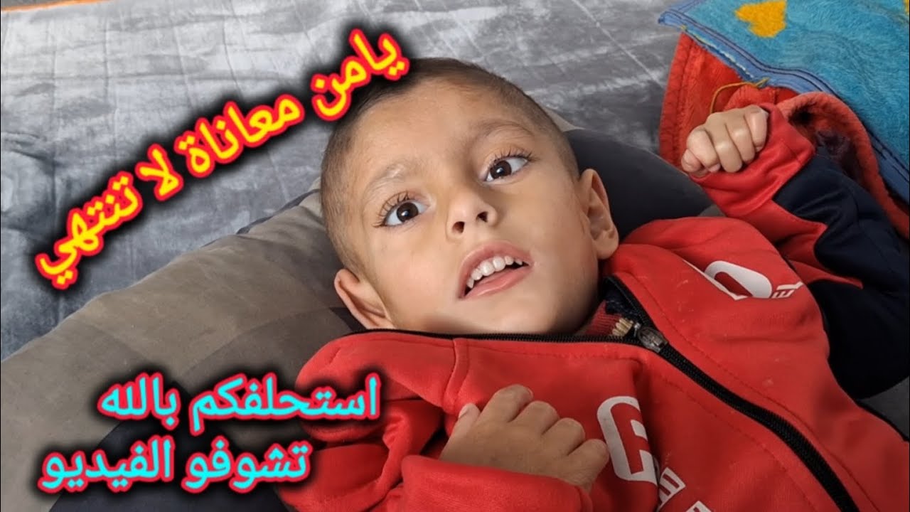 قصة يامن معاناة لا تنتهي ..#اكسبلور #كيدز #شلل_دماغي #كرسي_متحرك #ادعموا يامن