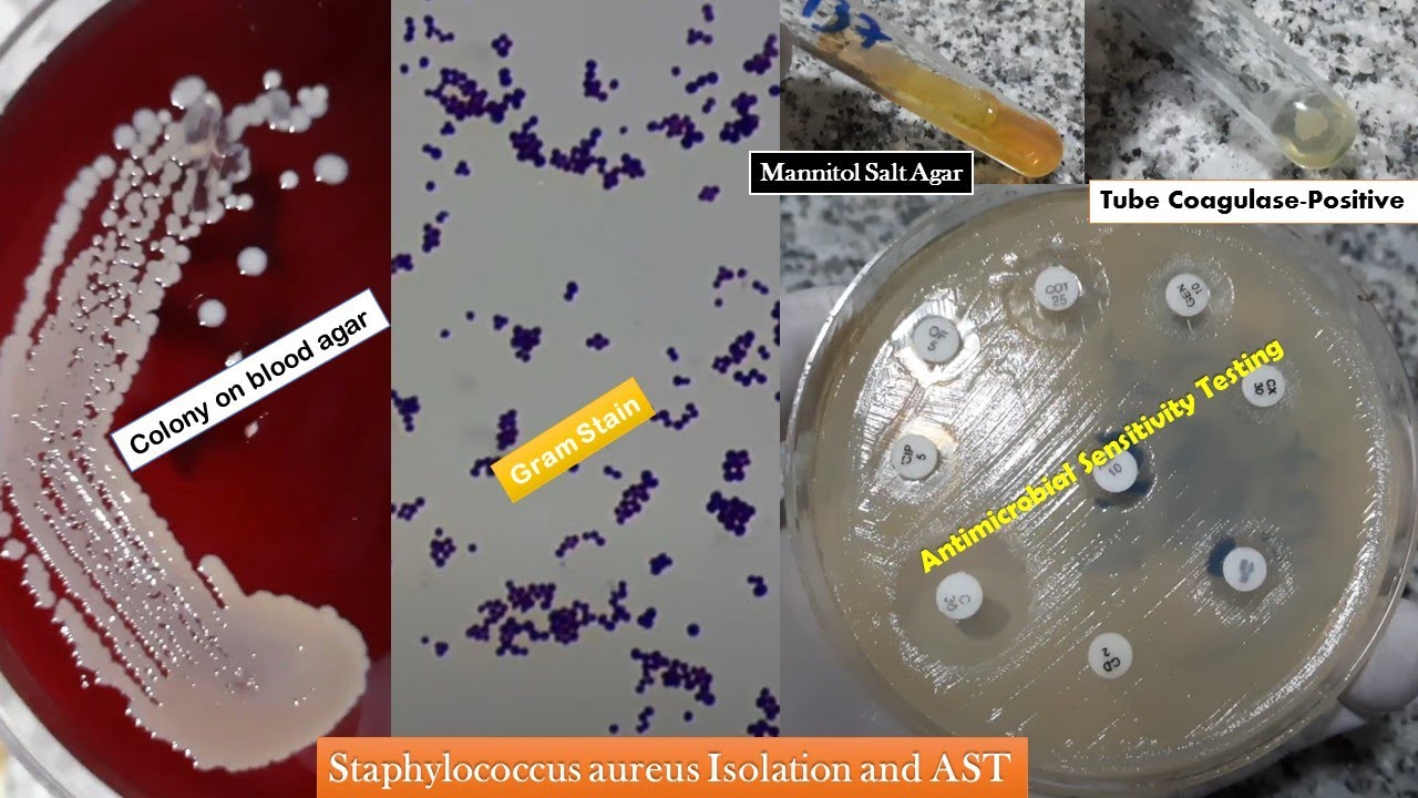 Staphylococcus aureus golden yellow colonies, Gram stain, Coagulase test, Growth on MSA and AST