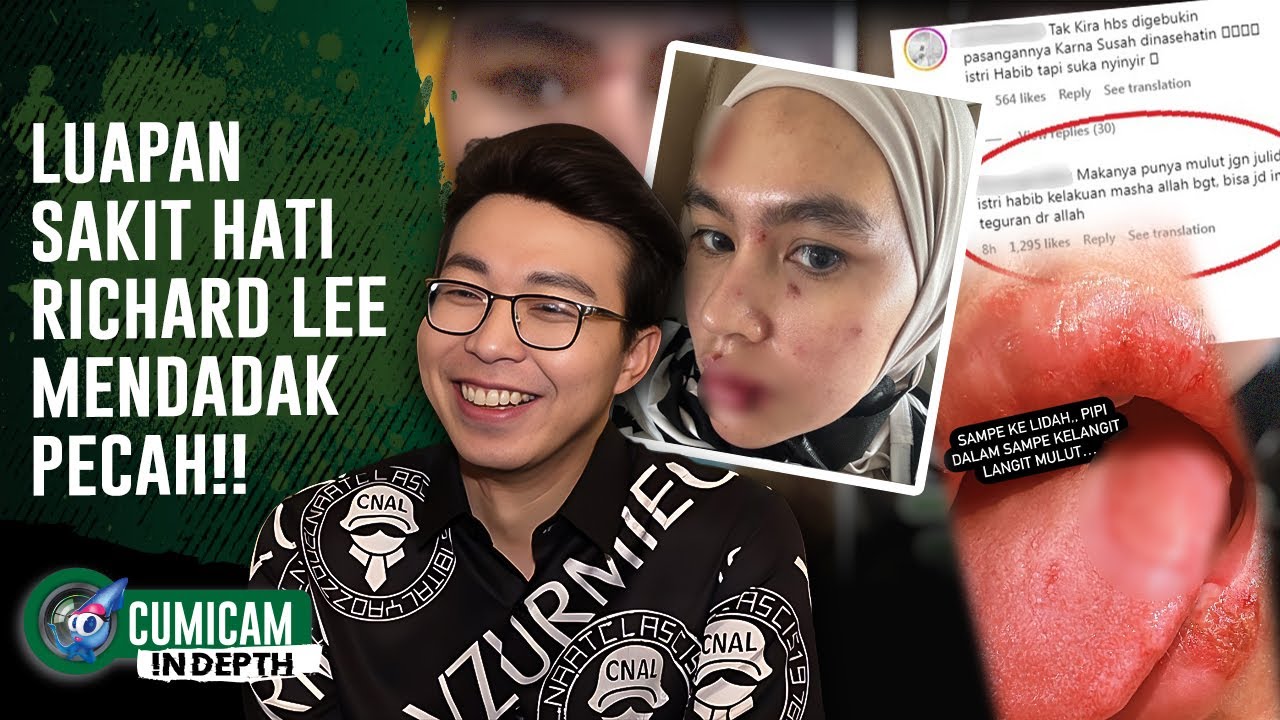 Kartika Putri Pastikan Luka di Wajahnya Bukan Azab, Richard Lee Bereaksi Begini! | INDEPTH
