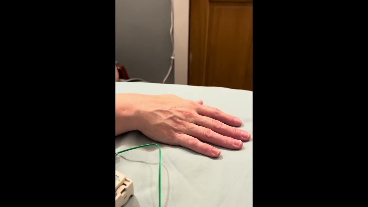 ITO ES 130 in Practice  Patient Treatments & Applications