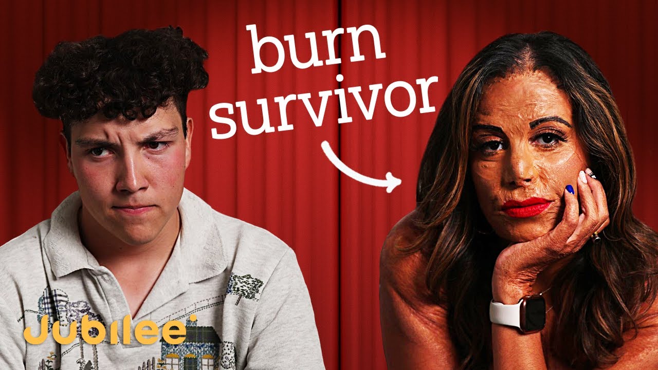 У меня всё лицо обгорело. Спрашивайте меня о чём угодно.