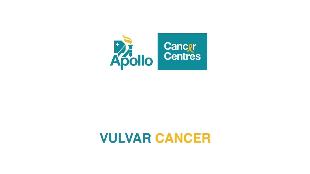 VULVAR CANCER - Gynaec Oncology - DR.S.AYYAPPAN