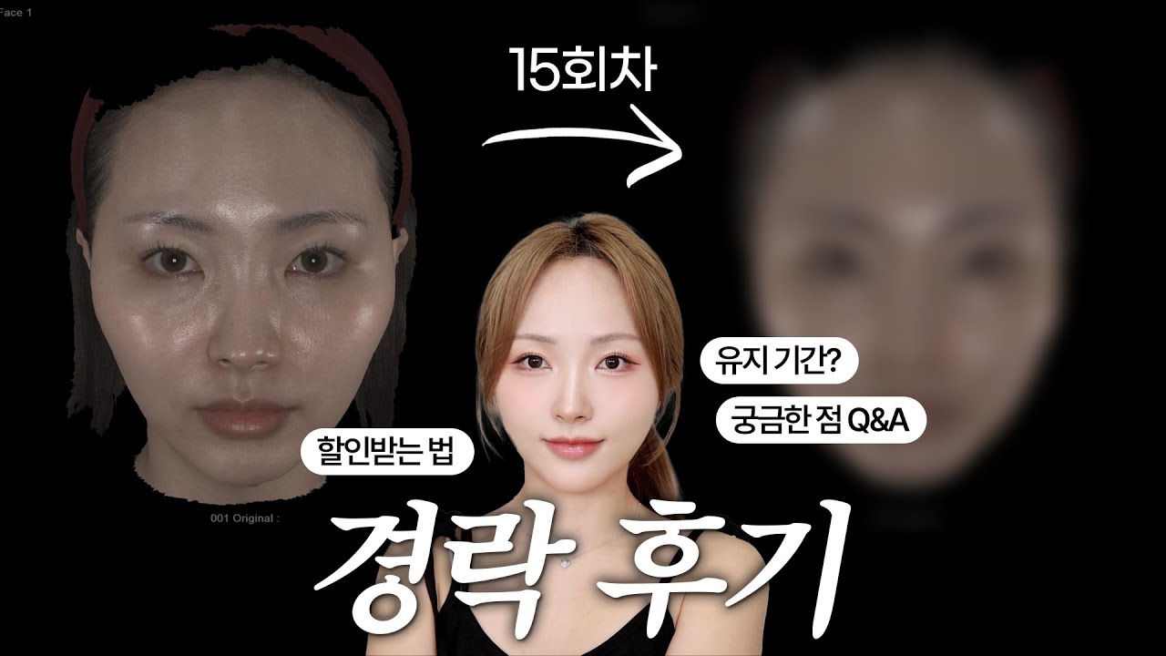 여백,옆광대 부자가 경락받으면?🌝15회 리얼 경락후기🔥전후 수치비교•비용•할인•Q&A•셀프마사지Tip•오래 유지하는법•경락샵 추천