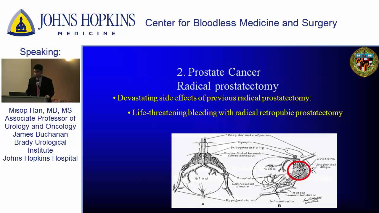 Center for Bloodless Medicine and Surgery: Minimally Invasive Urologic Surgeries