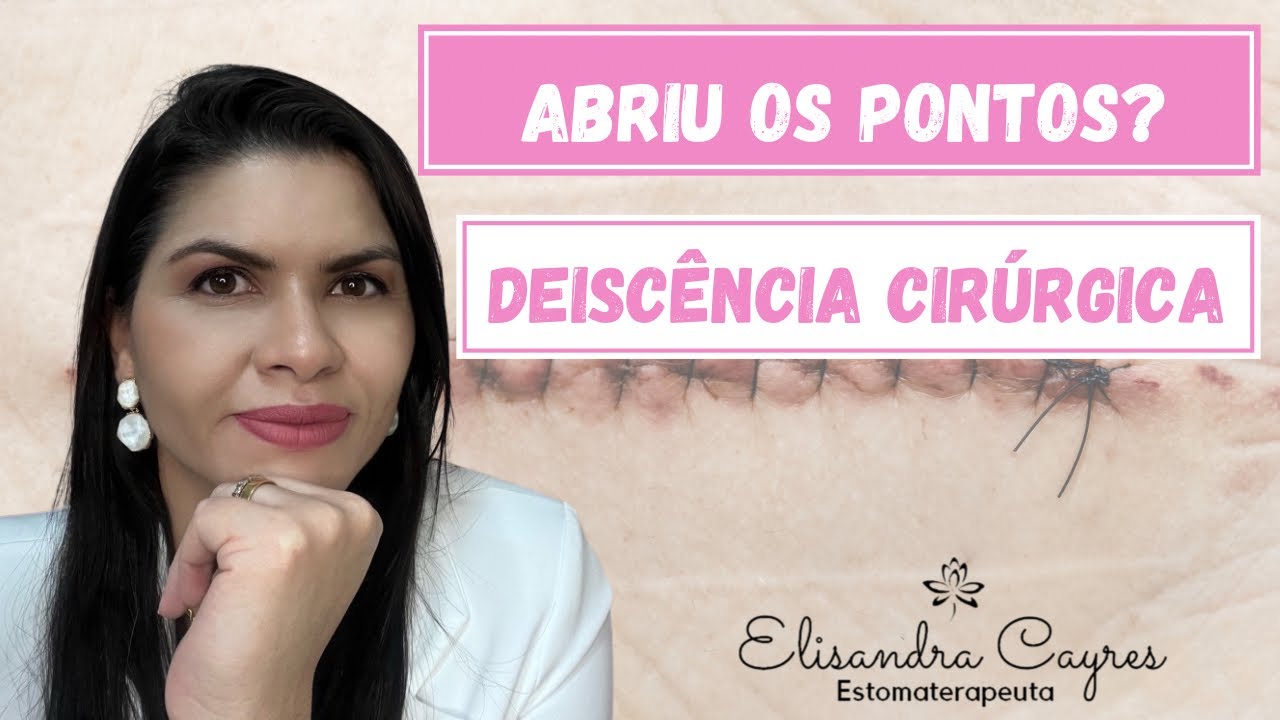 ABRIU OS PONTOS APÓS SUA CIRURGIA? DEISCÊNCIA CIRÚRGICA