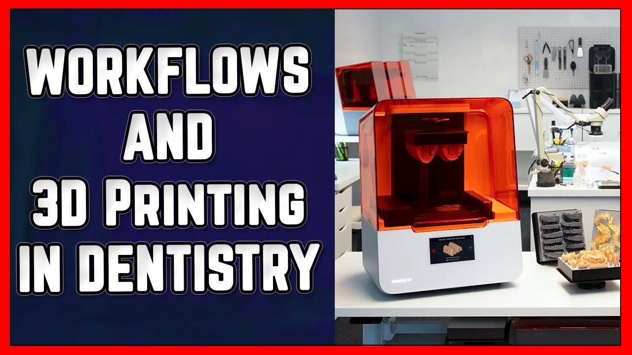 🦷 What Workflows Are Affected By 3D Printing?