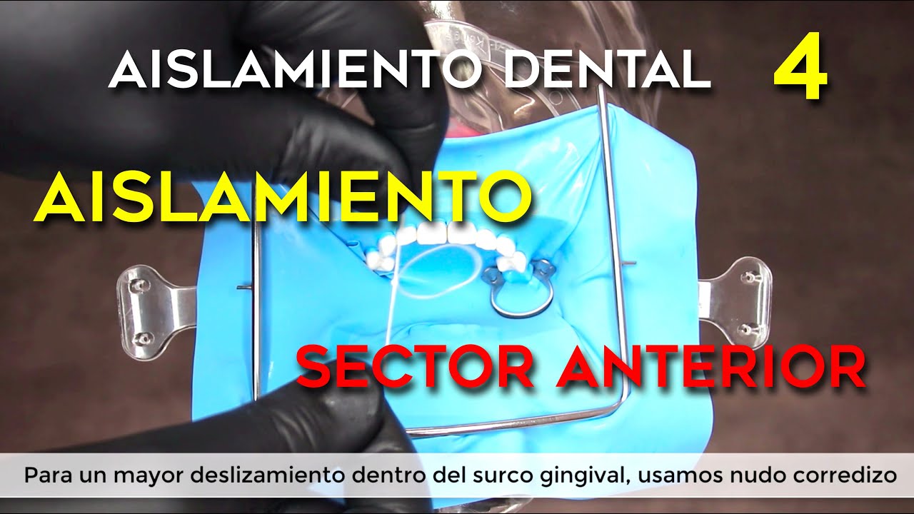 AISLAMIENTO ABSOLUTO DEL FRENTE ANTERIOR para odontolog&iacute;a restauradora, endodoncia y est&eacute;tica dental