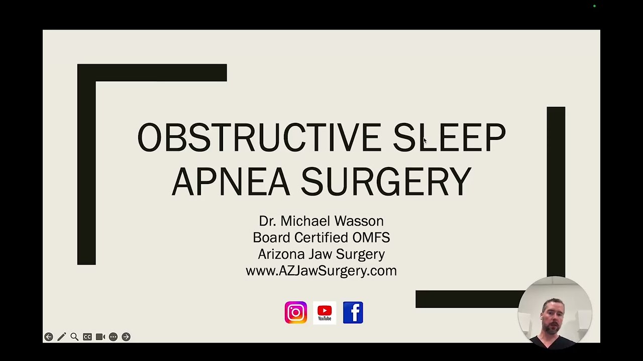 Obstructive Sleep Apnea Surgery (OSA Surgery)