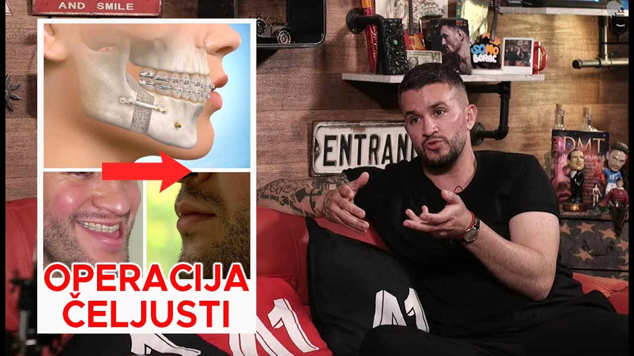 Damir Kedžo o operaciji čeljusti