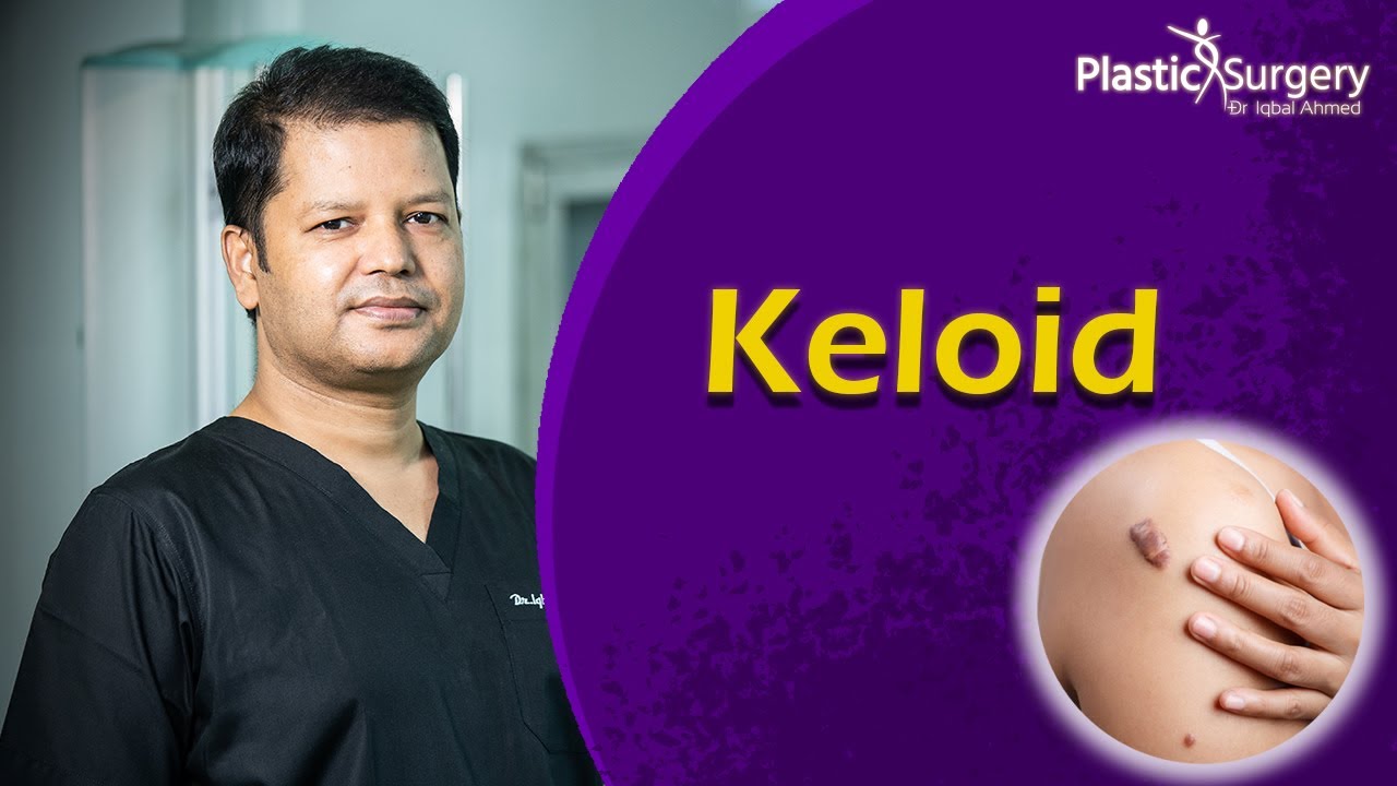 Keloid Treatment | ফুলে যাওয়া কাটা দাগের চিকিৎসা | Scar Removal