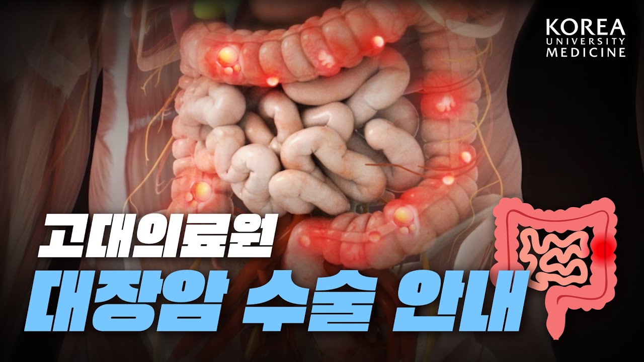 [수술 전 꼭! 확인] 대장암 수술 안내