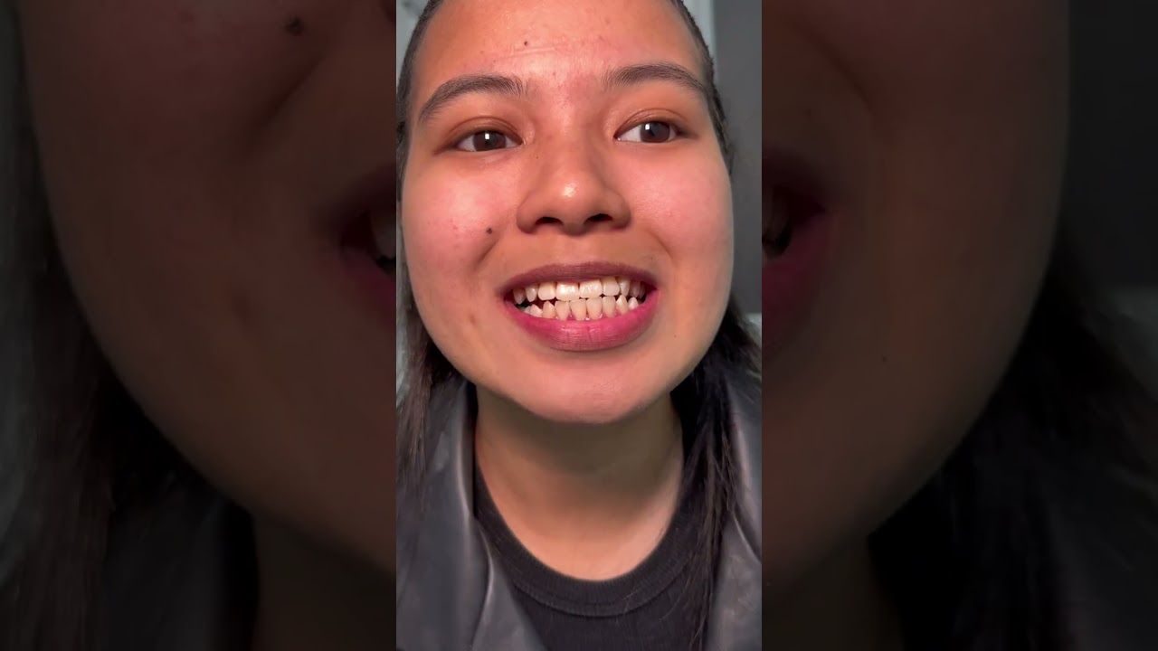 Check-Up ng Ngipin | EnvisionSmileDentalClinic